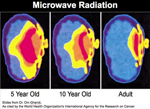 Brain Scans of Cellphone Radiation